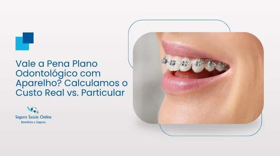 Vale a Pena Plano Odontológico com Aparelho? Calculamos o Custo Real vs. Particular